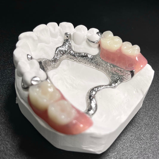 Vitallium Metal Framework