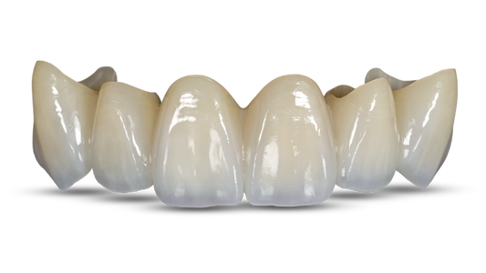 Layered Zirconia Crown