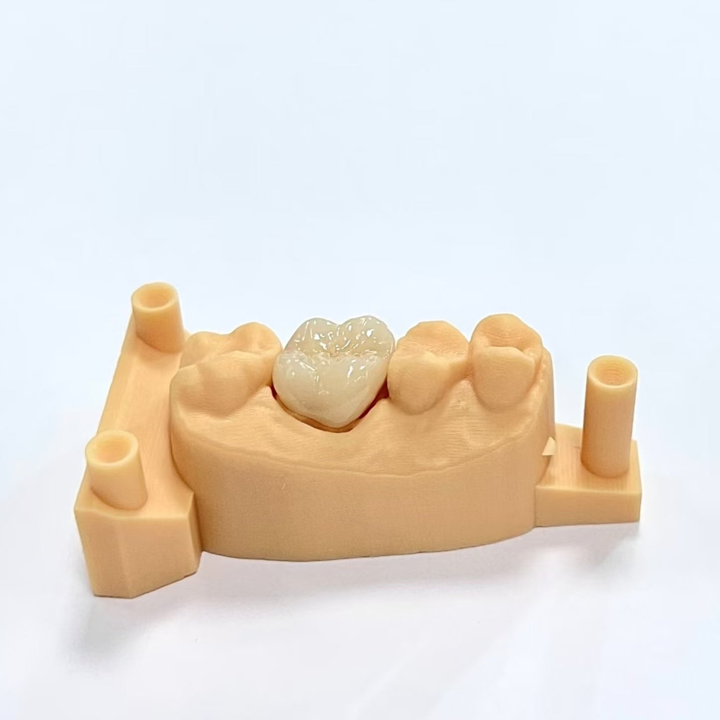 Full Contour Zirconia Crown