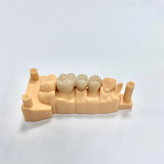 Full Contour Zirconia Crown