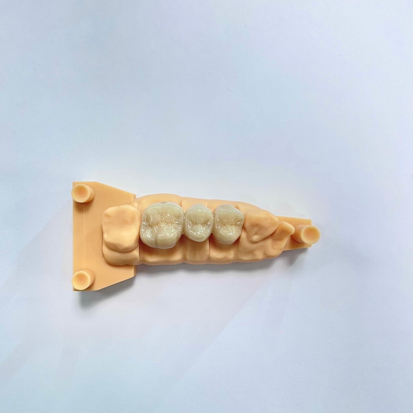 Full Contour Zirconia Crown