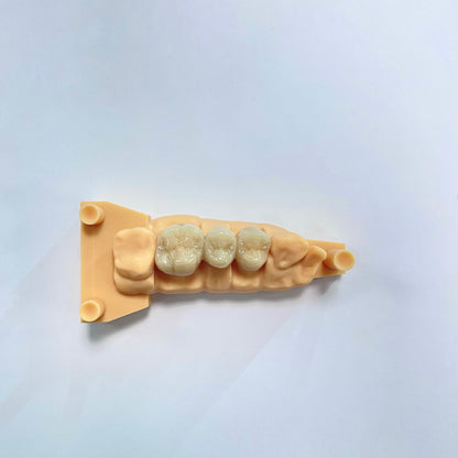 Full Contour Zirconia Crown